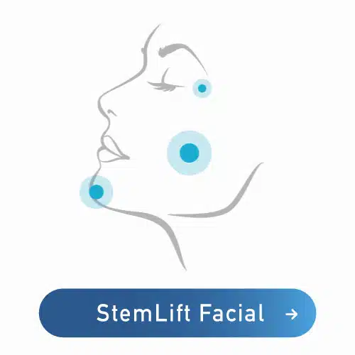 stem cell facial lift