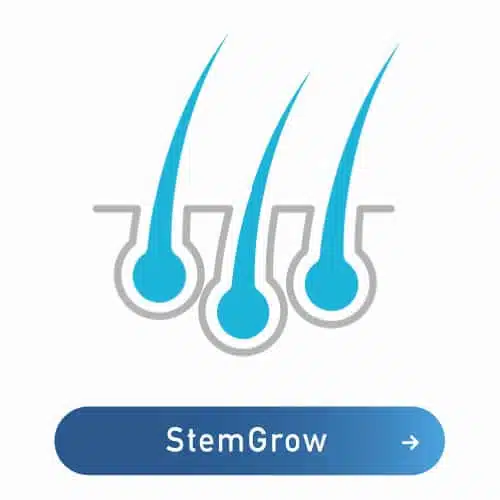 stem cell hair loss treatment