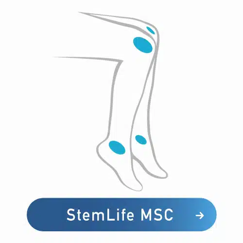 stem cell joints