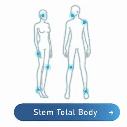 stem cell infusion